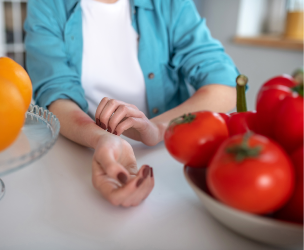 RECOGNISING ALLERGIC REACTIONS